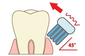 磨き方について