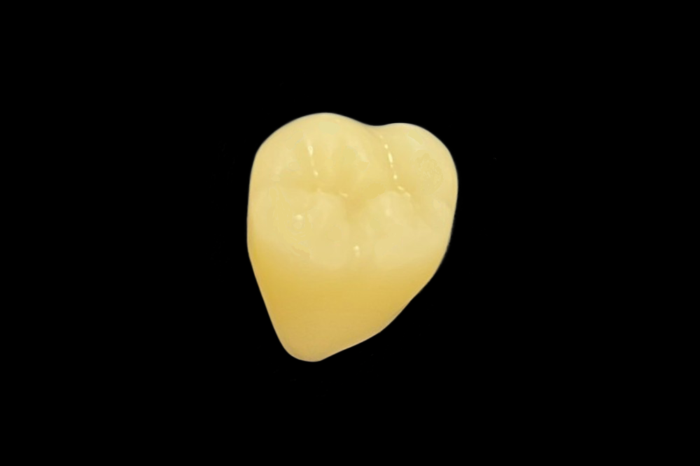 ①前歯部（犬切り歯から反対の犬切り歯まで）