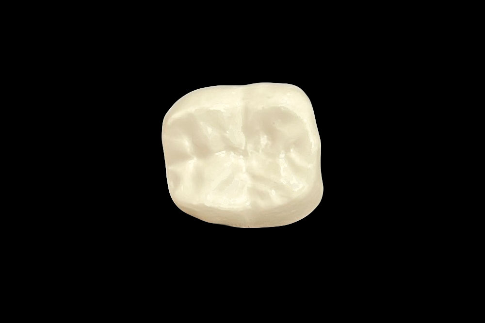 ③大臼歯部（顔の正中から数えて6番目と7番目の歯）